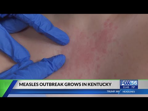 Mycase Kentucky