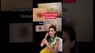 How to Treat Bug Bites #shorts | SkinByDrAzi