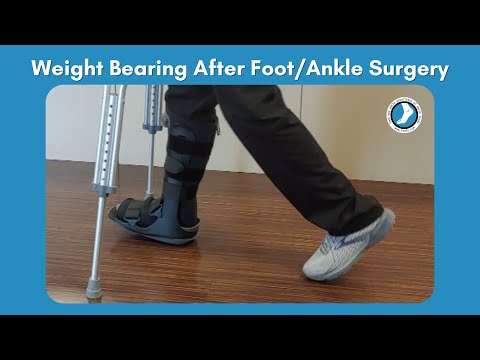 Weight Bearing After Foot Surgery