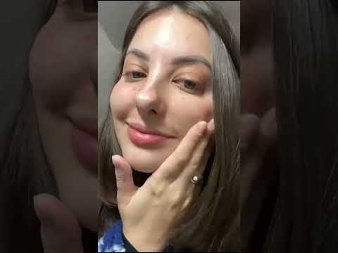 額頭長斑