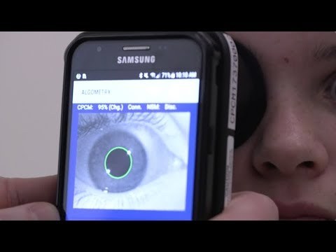 Researchers are hunting the first objective way to measure pain, what the National Institutes of Health calls a pain meter. Among the devices in early-stage testing: One that peeks into the eyes to link pupil reactions to pain. (Jan. 10)
