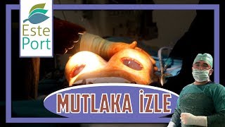 Meme Estetiği Olcaksan Mutlaka İzle!👄👌