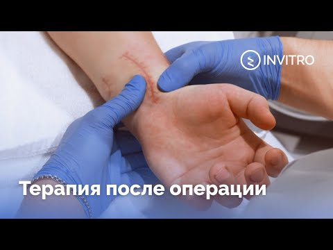 Tratamentul tendoanelor, mușchilor și cicatricilor postoperatorii