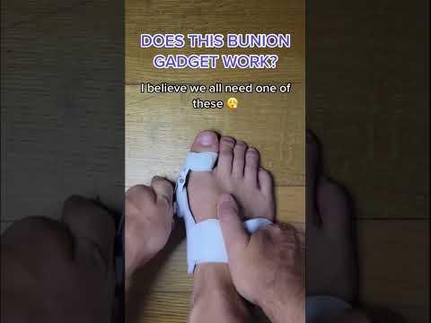 Viral Bunion Fixing Tool?! 😱 #shorts