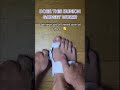 Viral Bunion Fixing Tool?! 😱 #shorts