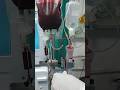 What Are The Benefits Of Blood Transfusion During Dialysis Comment Science Dialysis Diatomic
