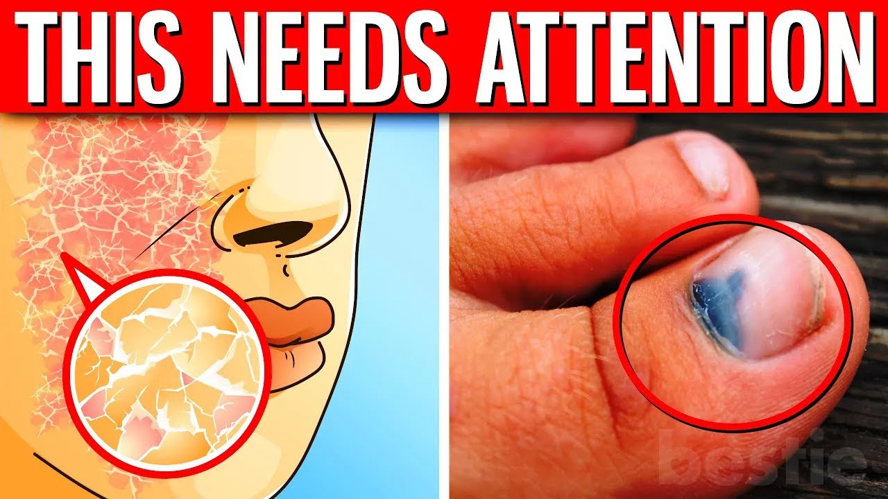 10 Body Changes That Need Your Attention ASAP