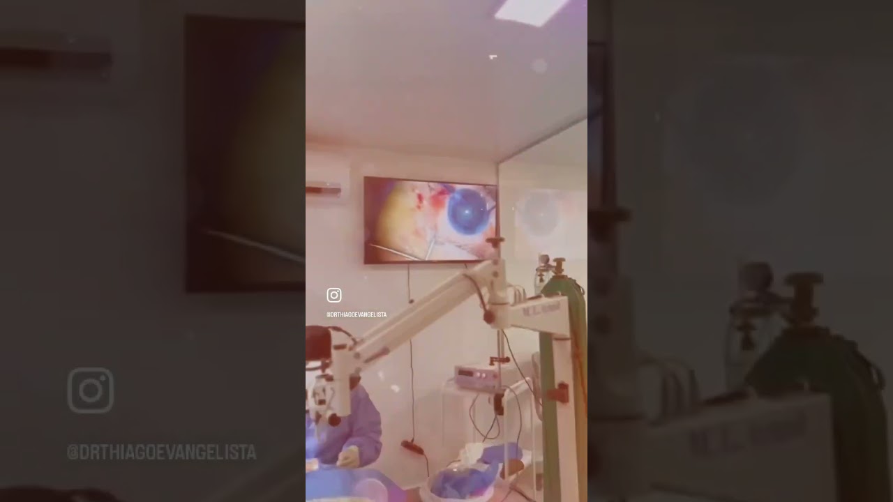 Rotina cirúrgica de catarata!!