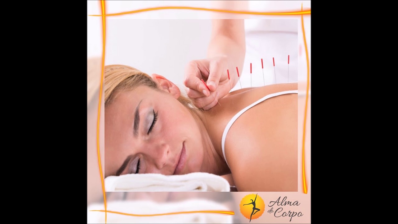 10 Benefícios da Acupuntura (podcast) 📍