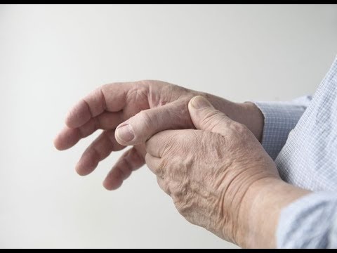 Koślawe kolana anatomicznie Palucha kąt valgus
