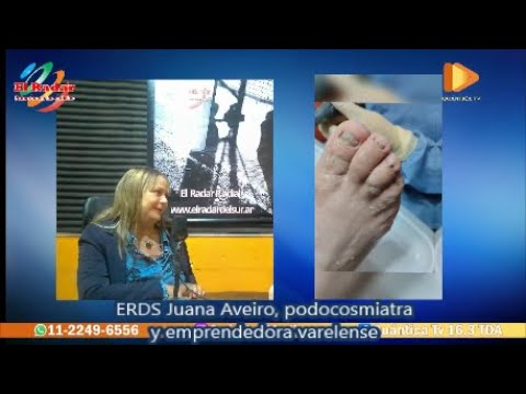 ERDS- Juana Aveiro, podocosmiatra y emprendedora varelense