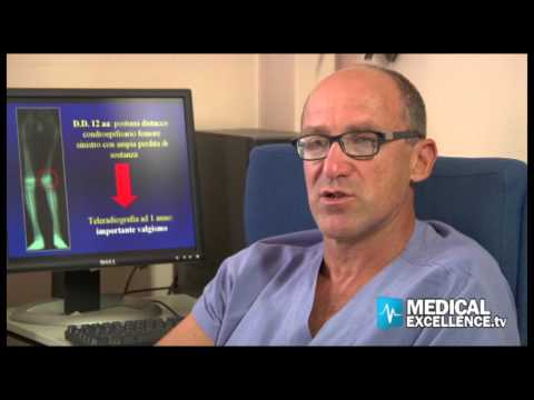 Ricarica con osteocondrosi con un bastone Bruciore di osteocondrosi