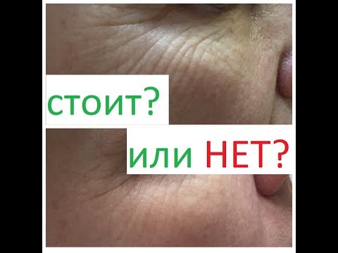 Крем от пигментных пятен на лице российский К чему сниться веснушки