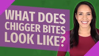 What does chigger bites look like