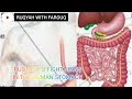 RUQYAH TO DISTROY JINN LIVING IN STOMACH AND THROUGH EATING AND DRINKING