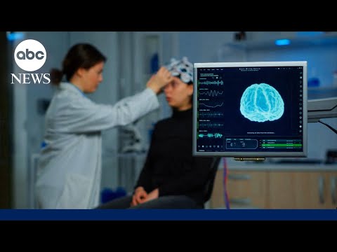 Brain aging study finds adolescence may continue until age 32