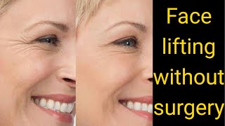 Download Lagu Face Lift without Surgery | Dr Sham Sunder Goyal MBBS MD Thumbnail