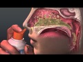 Can Saline Irrigation Help Nasal Allergies Animated Guide To Saline Nasal Irrigation