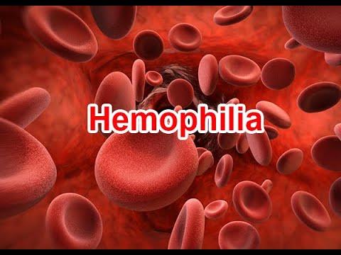 Bệnh hemophilia là gì?
