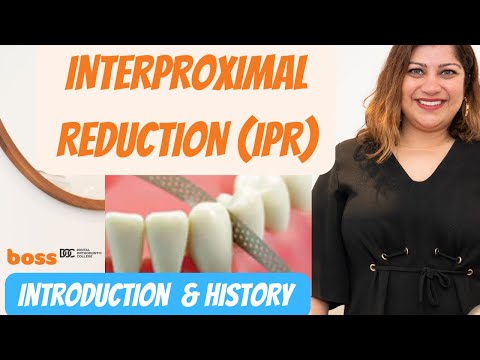 Did you know this about Interproximal reduction/ stripping / IPR in orthodontics?