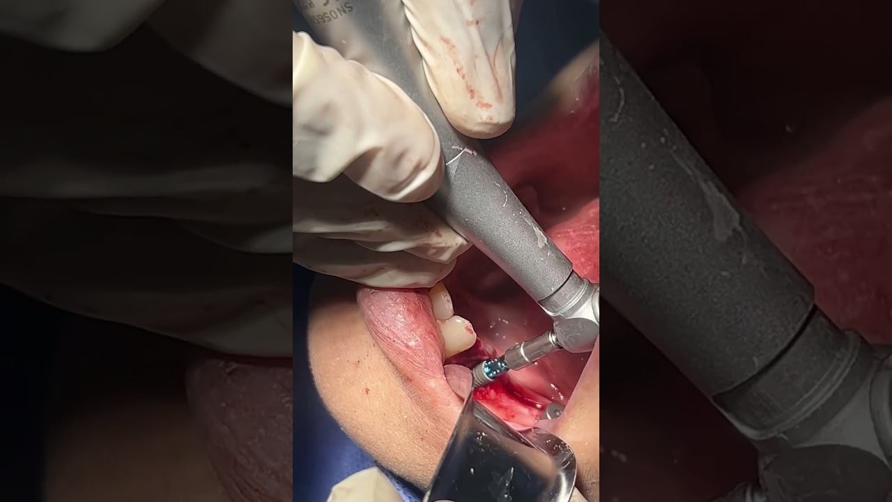 José Antonio Vázquez Mendoza-20