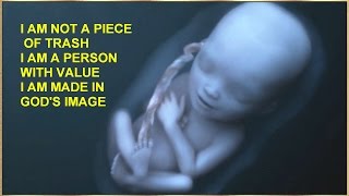 A Precious Life &amp; Destiny From God Destroyed When People Have Abortion - Jesus Christ - Pro-Life