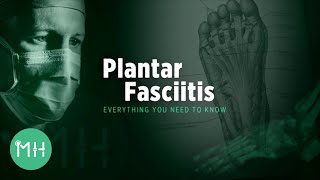Plantar Fasciitis - Everything you need to know