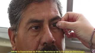 DIF ESTATAL HIZO ENTREGA DEPROTESIS OCULARES, GRACIAS A LAS GESTIONES DE LA PRESIDENTA ELVIRA BARRAN