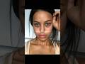 Dark Circles Under Eyes Shorts Youtubeshorts Beauty Pretty Insecurity Darkcircles Relatable