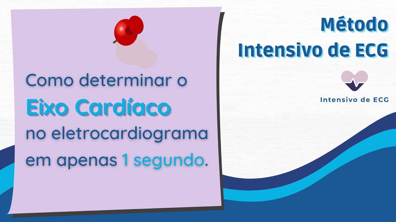 Como determinar o eixo cardíaco no eletrocardiograma - em apenas 1 segundo!