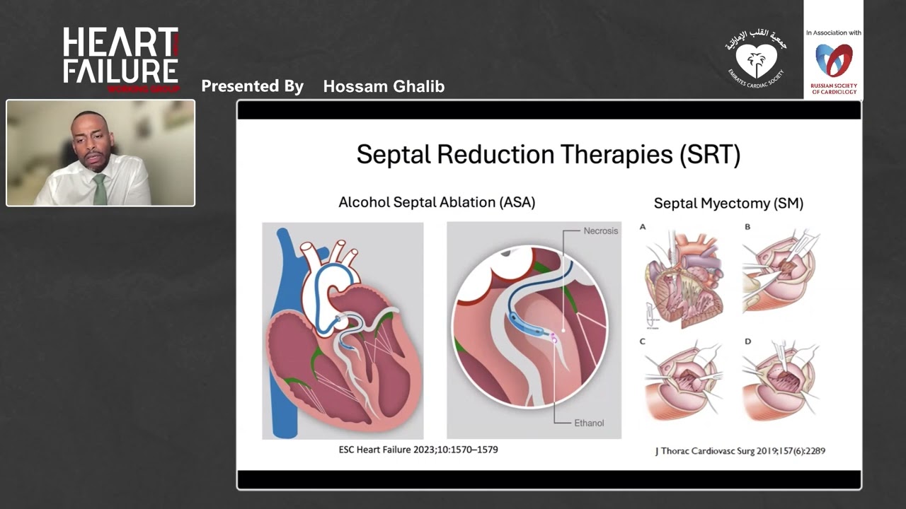 ECS Heart Failure WG Wave 3  10 November