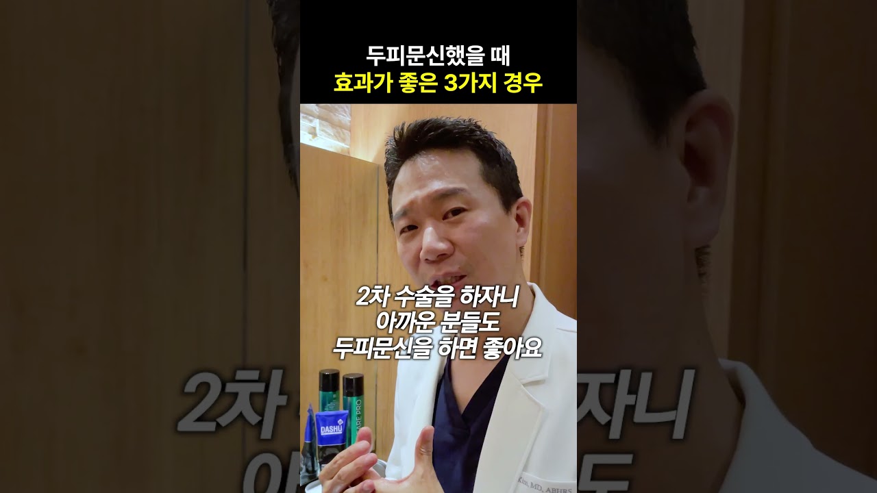 두피문신하면 효과가 좋은 경우 3가지