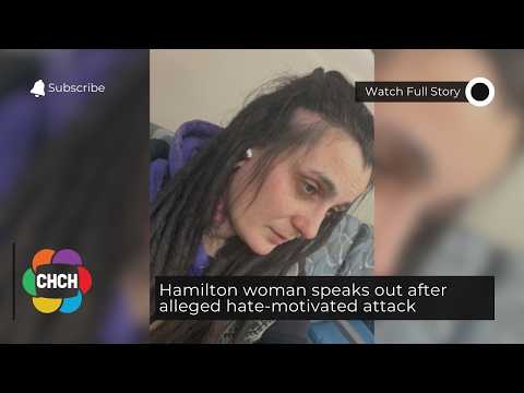 Hamilton woman speaks out after alleged hate-motivated attack