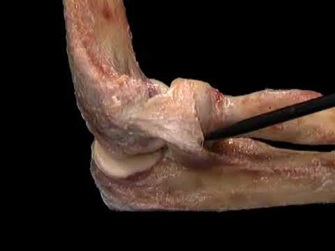 Dolor de lado izquierdo, tirando de la demora de la cintura Dolor en el hoyuelo en su cuello