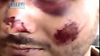 preview picture of video 'Siria, Baniyas, Manifestantes TORTURADOS Brutalmente por milicias de regimen, 13/04/2011'