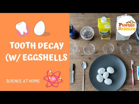 Tooth Decay w/ Eggshells