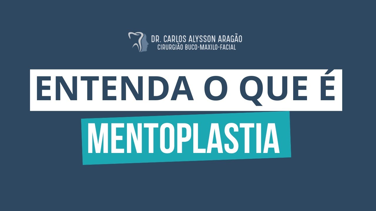 Carlos Alysson Aragão-45