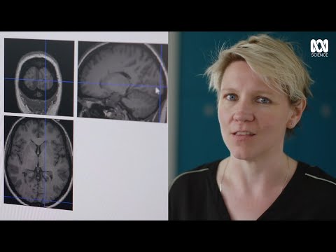 How mindfulness meditation reshaped her brain | Catalyst