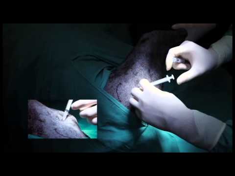 Lateral Hip Joint Injection - Polyglycan-SA - Canine