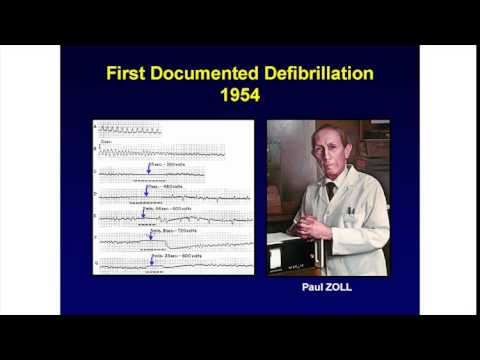 Schrittmacher, die den Rhythmus steuern