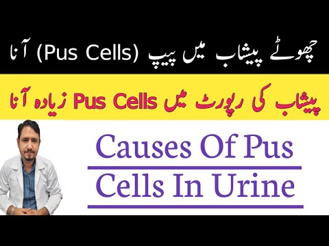 Pus cells in urine urdu hindi - Irfan Azeem