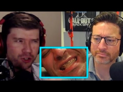 PKA Reacts to ONLYUSEmeBLADE's Teeth