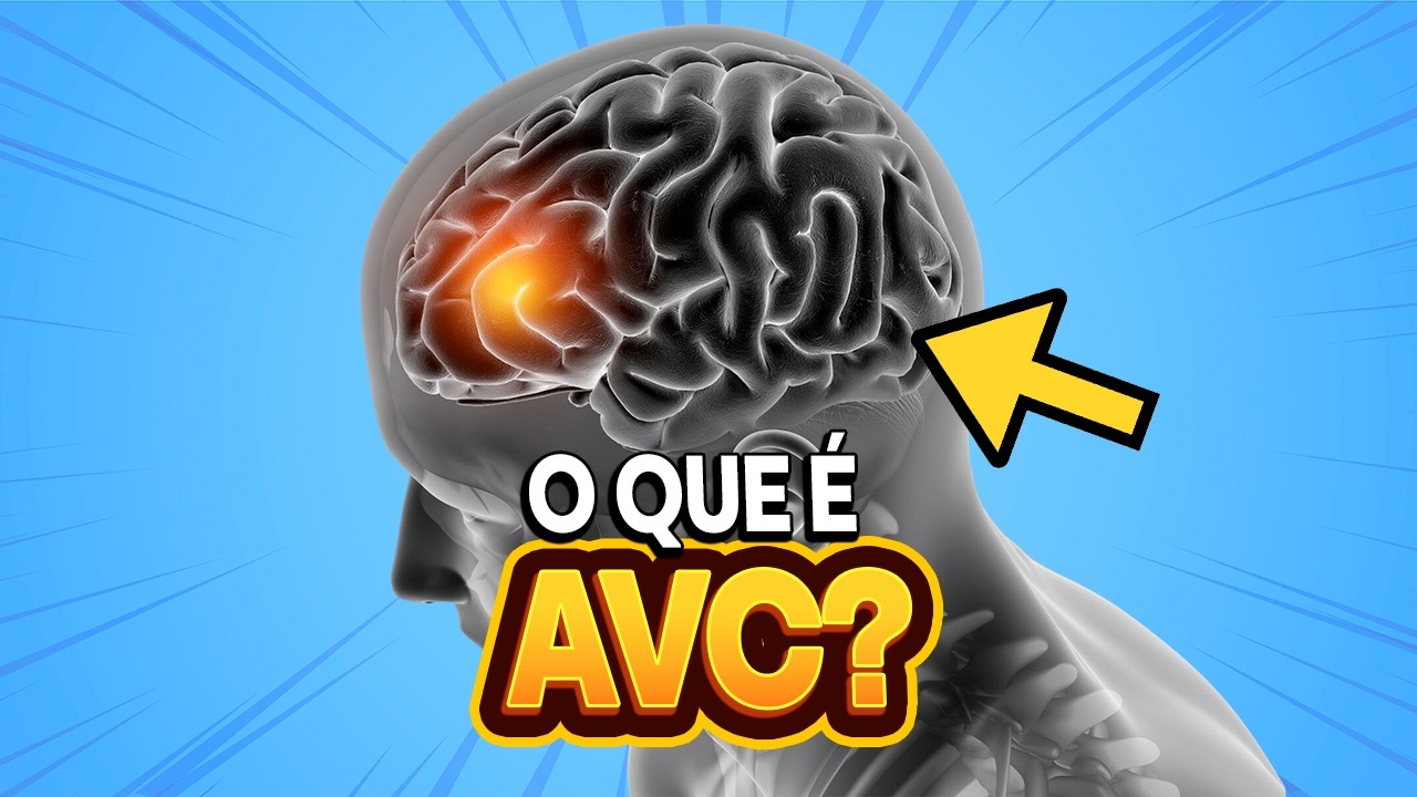 O que é AVC ? | IMEB