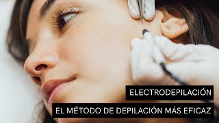 Ventajas de la Electrodepilacion. ¿Es el método de depilación más eficaz