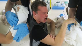 THEY RIPPED MY CAST OFF!!! *EXTREME PAIN!*