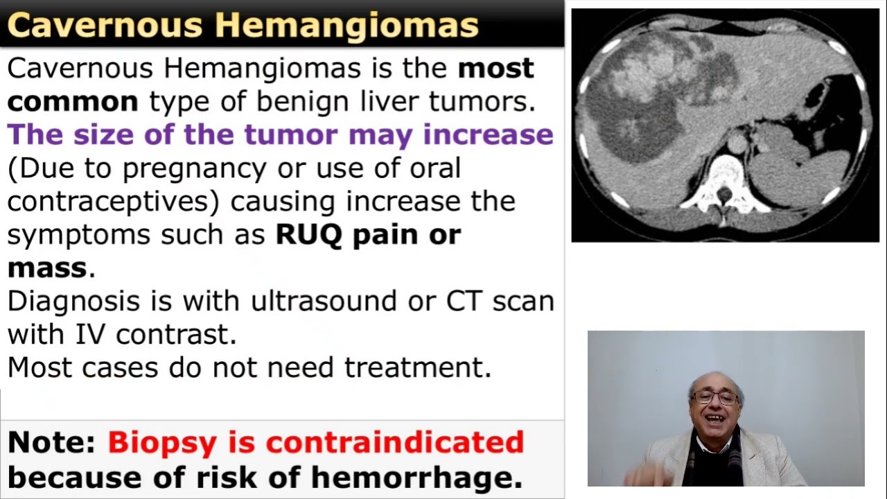 Cavernous hemangioma of the Liver