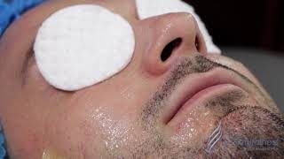 LIMPIEZA FACIAL PROFUNDA