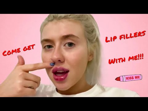 I GOT LIP FILLERS FOR THE FIRST TIME…