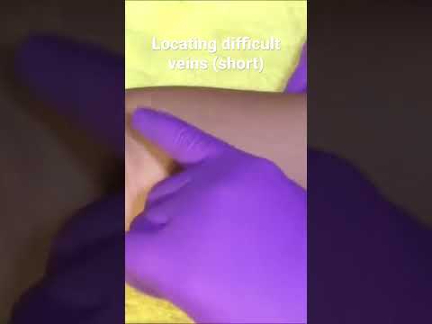 Locating difficult veins (short)