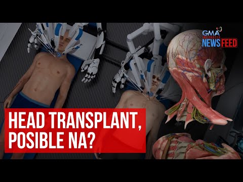 Head transplant, posible na? GMA Integrated Newsfeed